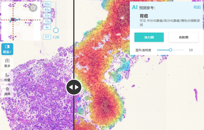 AI破局医疗“不可能三角” 京东云推动大模型全面走向深度应用(图4)