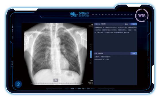AI重构医疗生态 深睿医疗大模型新品闪耀2026医学装备展(图6)